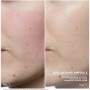 Traitement Facial Babor Sos Calming